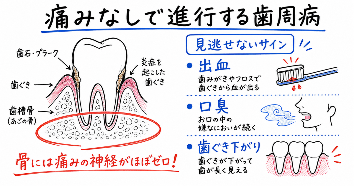 口臭や出血はサイン？歯周病が痛みなしで進行する理由と症状