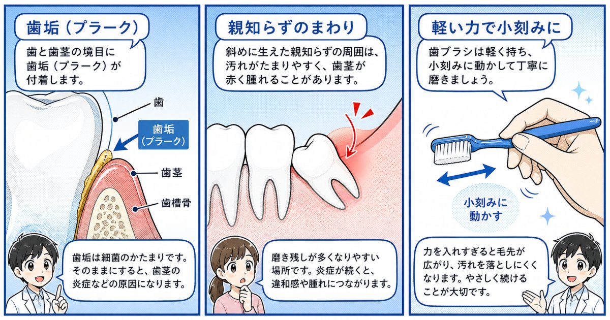 歯磨き時の出血や歯茎の腫れを引き起こす主な原因