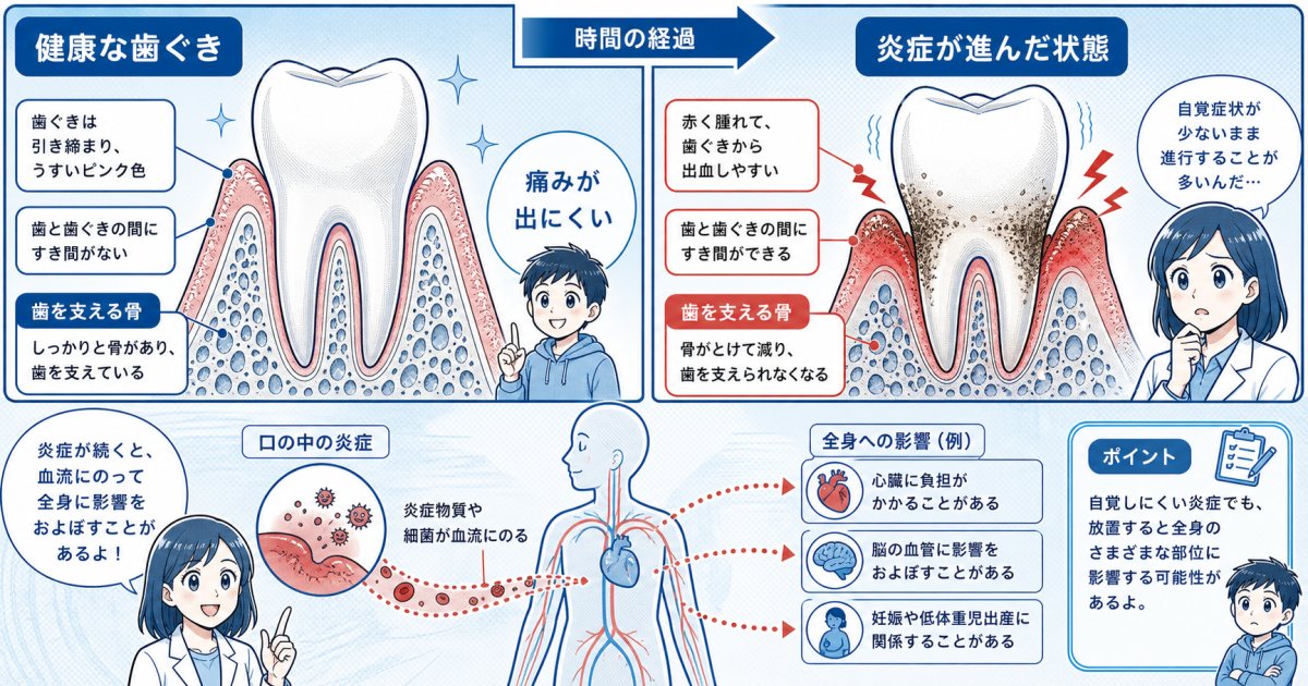 「痛くないから大丈夫」は誤解？歯茎の腫れ・出血を放置する危険性