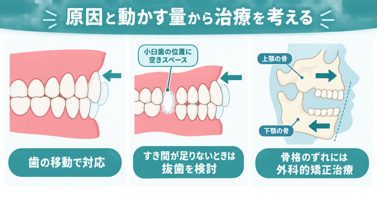 口ゴボの改善治療では、抜歯や手術が必要ですか？